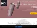 ndi-implant